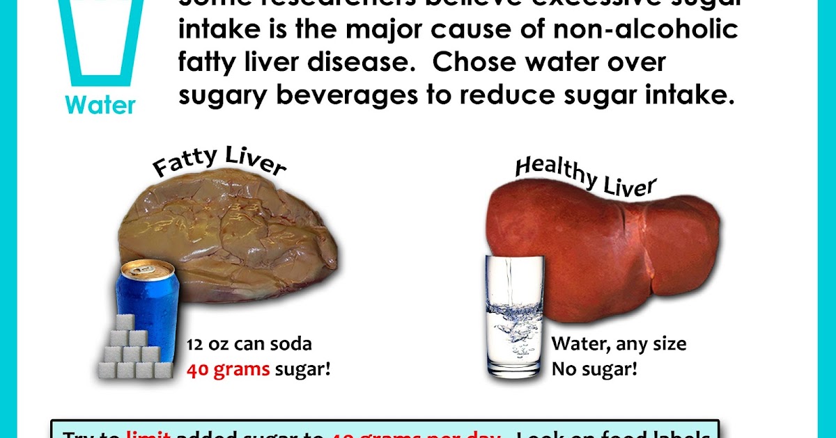 8 Habits to Health Sugar and Fatty Liver (click on image to enlarge)