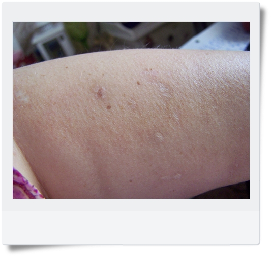 Pflege Fur Die Haut Bi Oil Produkttest Annie Online Magazine For Fashion Lifestyle Beauty