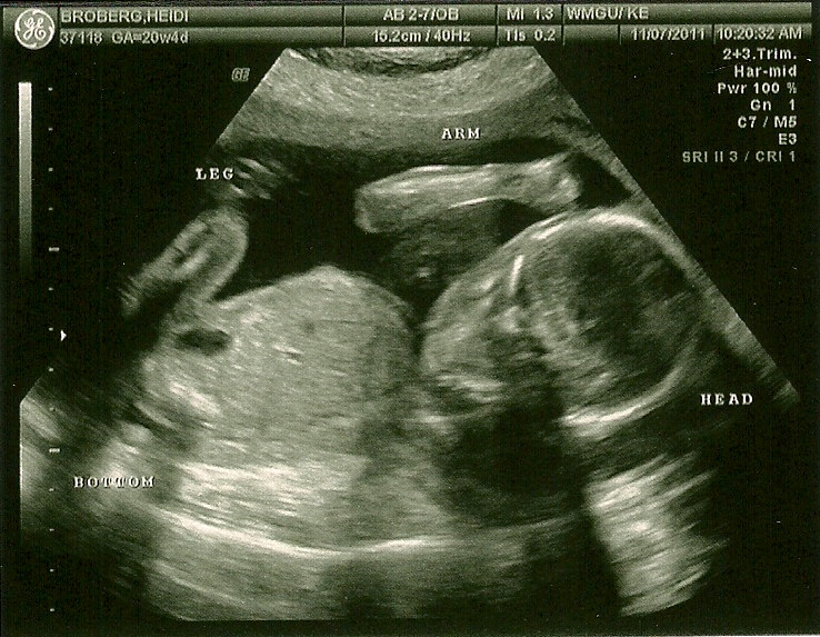 Ultrasound Scan Boy