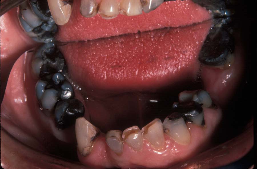 Bridge River Picture Bridge In Mouth