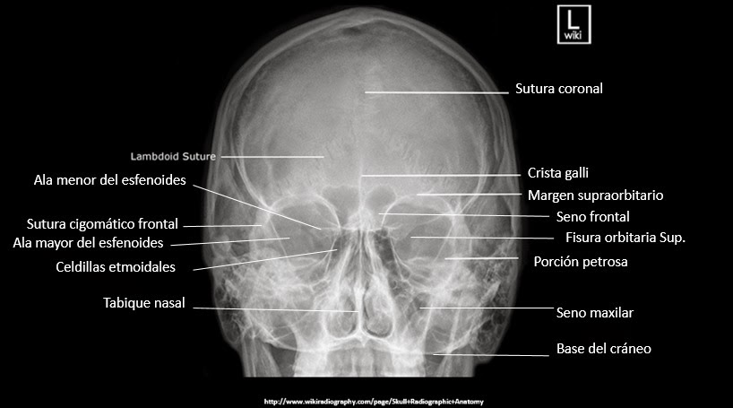 ESPE 202 - 2014: Anatomía y patologías de la cavidad orbitaria