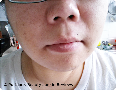Oxy Cover Acne Pimple Medication Oxy Cover Acne Pimple Medication