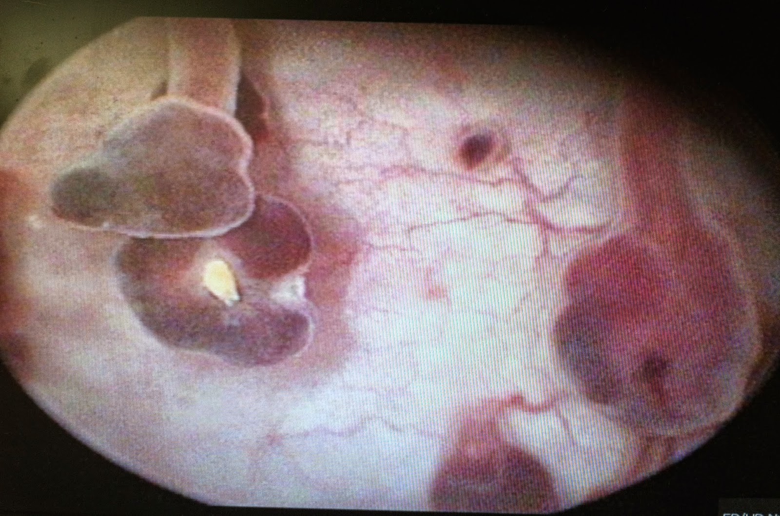 bladder cancer dogs
