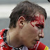 Tour de France 2011: Stage 6 Preview and Betting