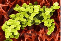 Pengelompokkan Bakteri