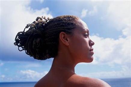 A Toast To Wealth Black Women Tight Braids Gave Me Alopecia Now