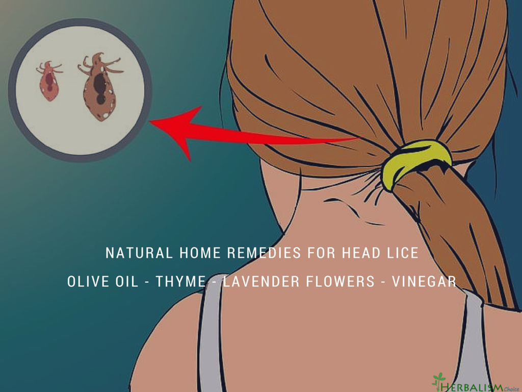 Home Remedies For Head Lice Herbalism Choice