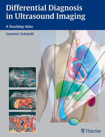 Differential Diagnosis in Ultrasound Imaging: A Teaching Atlas 