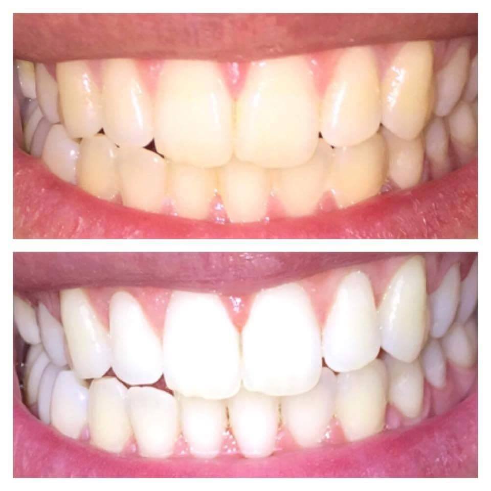 For You, For I, For All Whitening Toothpaste