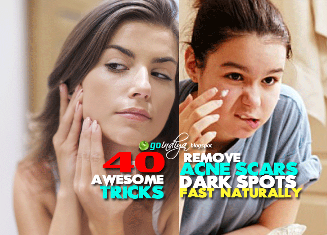 How To Remove Tan Naturally At Home How To Remove Tan Naturally At Home