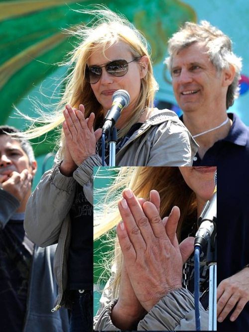 Celebrity Deformities