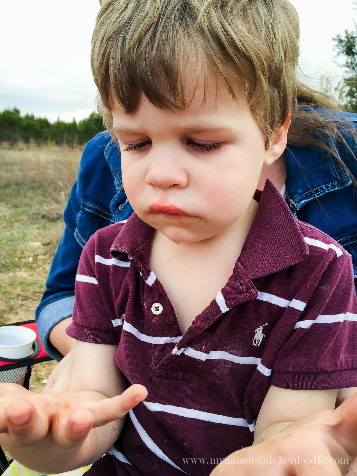 How To Remove Cactus Needles From Skin My Name Is Snickerdoodle