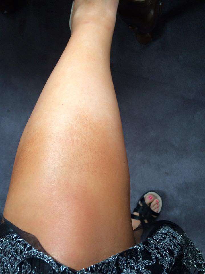 Spray Tan Problems And Quick Fixes So You Boutique