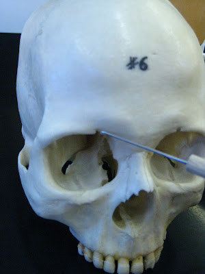 Boned: Human Skull - supraorbital foramen (of frontal bone)