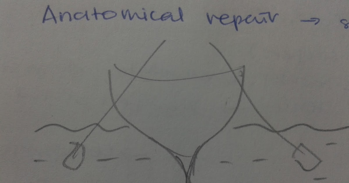 The Triggers of My Inner Mind keel