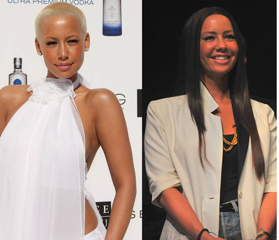 Pearl Concussion Amber Rose Graces Her Head