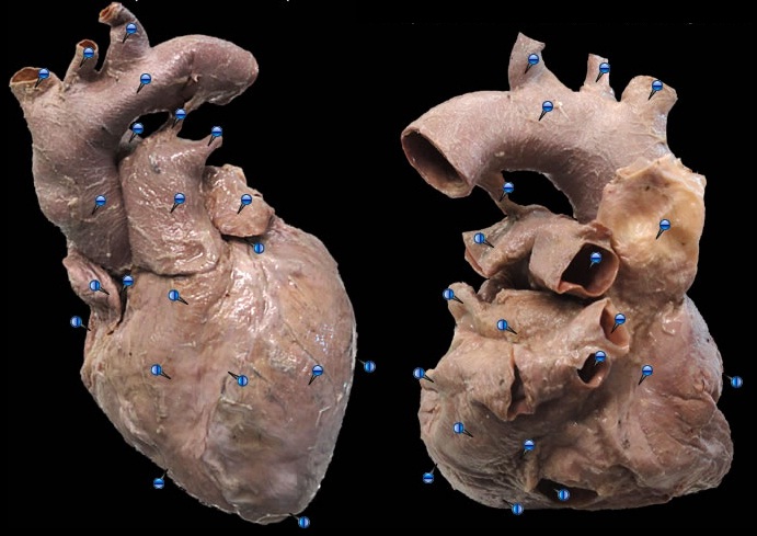 Anatomia fotos reais - Imagui