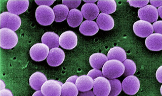 Staphylococcus Aureus. Staphylococcus Aureus.