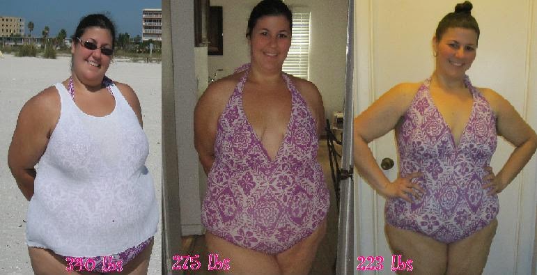 100lb Weight Loss Stories