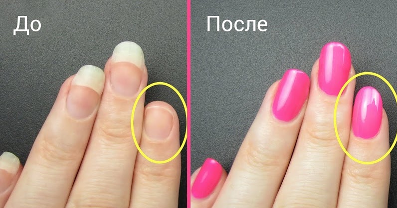 Как отбелить кожу на лице отзывы Как отбелить кожу на лице отзывы