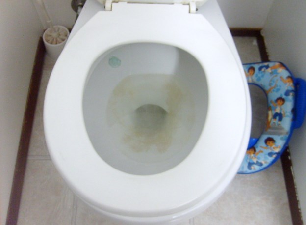 common toilet malfunctions