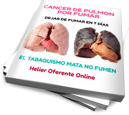 CANCER DE PULMON POR FUMAR