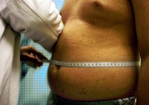 paciente sobre peso obesidad gordura dieta
