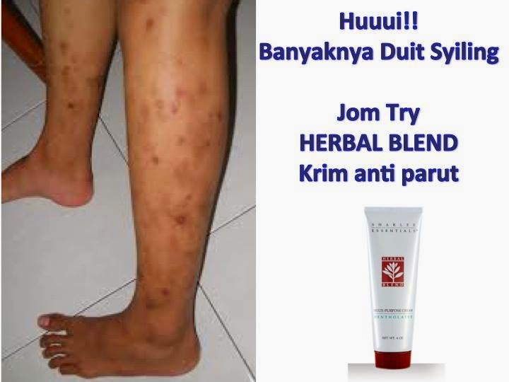 Cara Hilangkan Parut