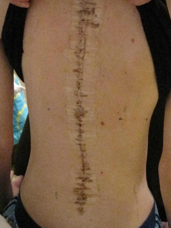 Brace Yourself: February 2011