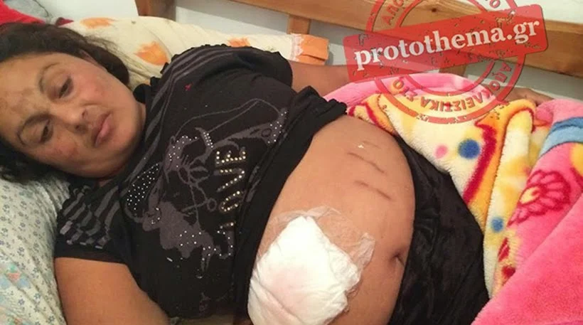Ληστές μαχαίρωσαν στην κοιλιά έγκυο γυναίκα στα Πατήσια! (ΦΩΤΟ & ΒΙΝΤΕΟ) 