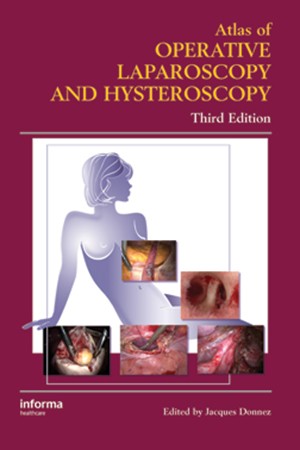 Atlas of Operative Laparoscopy and Hysteroscopy, Third Edition  