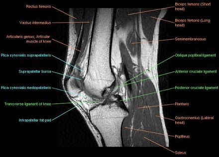 ABC Radiology Blog: Knee Joint