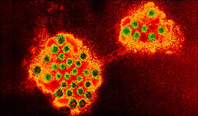 Medical Microbiology: Norovirus
