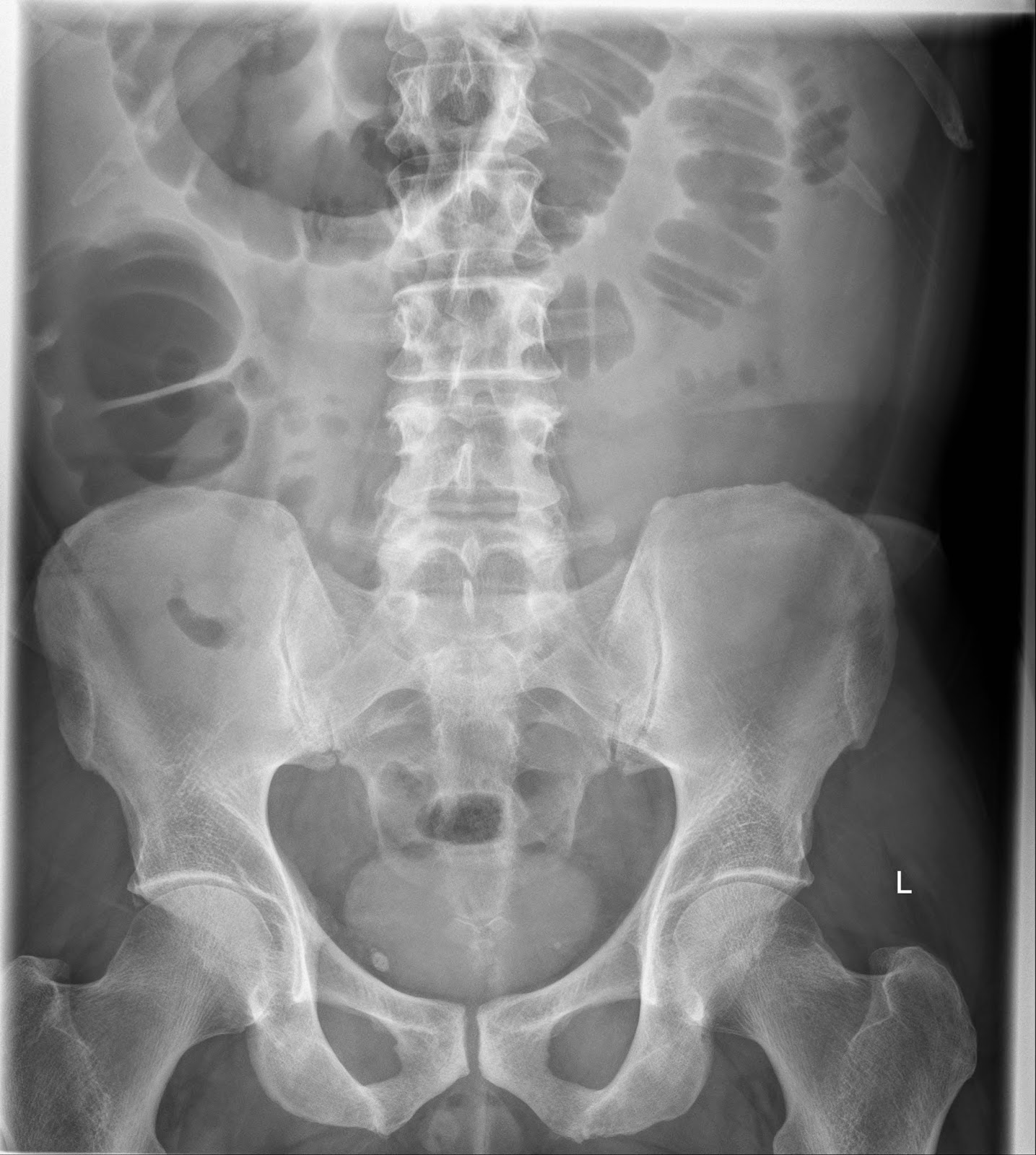 the xray doctor xrayoftheweek 13 can you pinpoint the site of pathology?