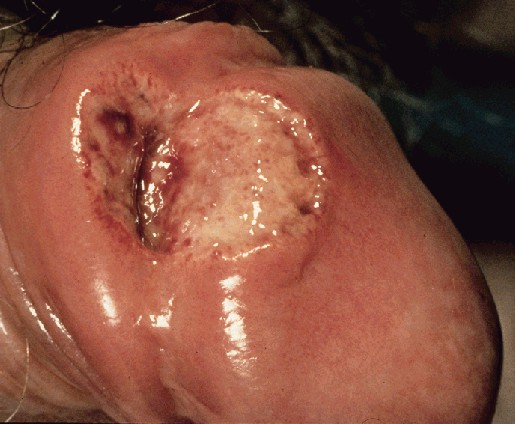 Something is. Disorders of the vagina that Amusing Disorders of the vagina authoritative point