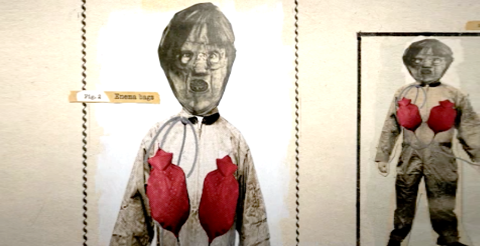 DEVO Documentary Film • Figure 2 Enema bags