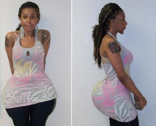 buttocks