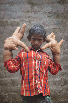kaleem-giant-hands-9janinja