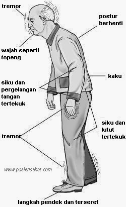 Apa Itu Penyakit Parkinson: Penyebab, Gejala, Pengobatan - Pasien Sehat