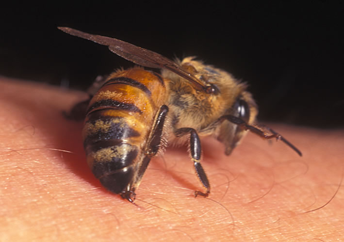 Sting Bee