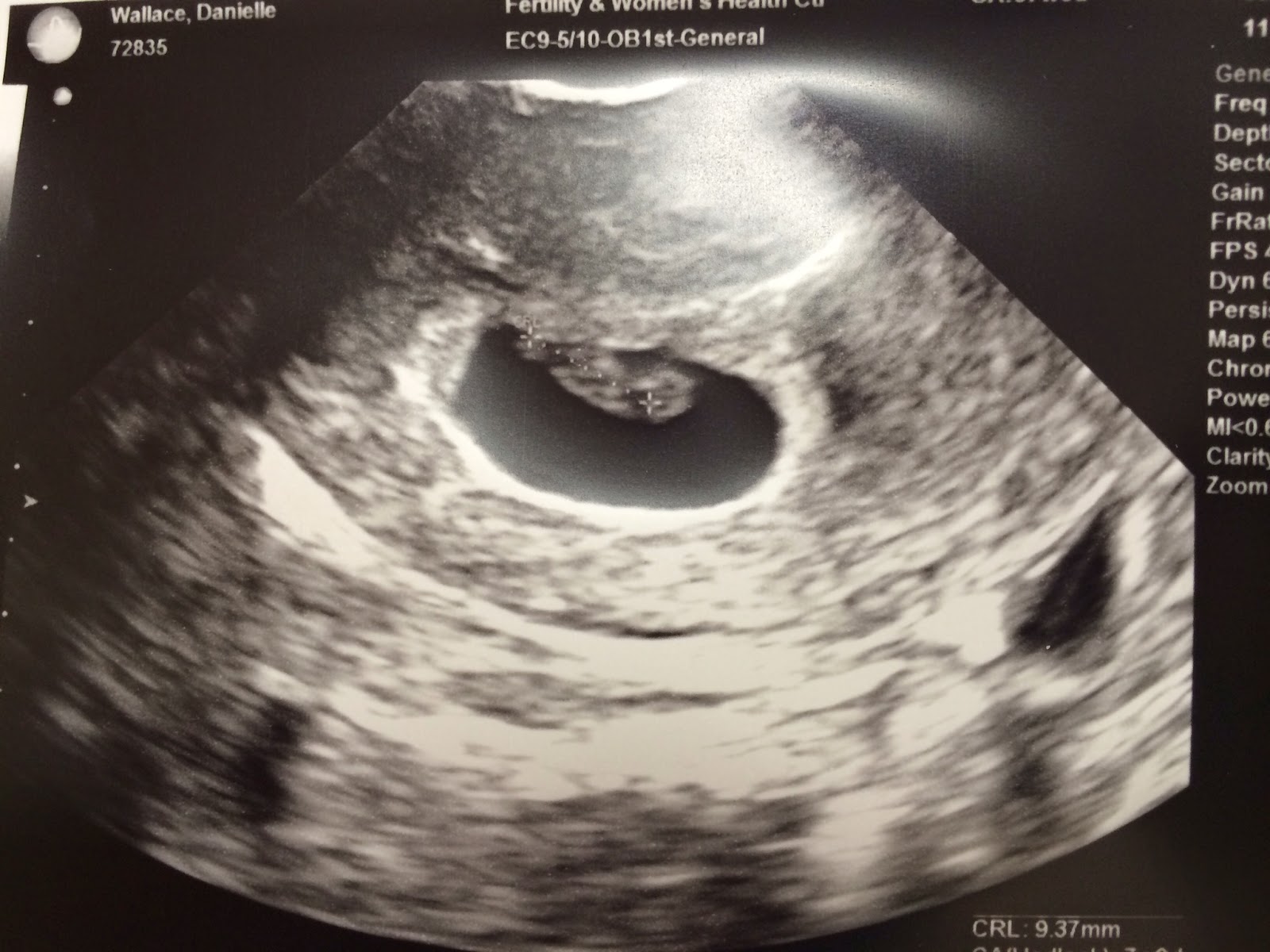 by God's grace: 7 weeks + our 1st ultrasound
