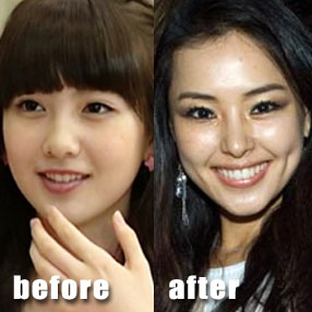 Korean history: plastic surgery