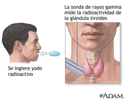 Un pequeño montecillo sobre la cabeza del pene