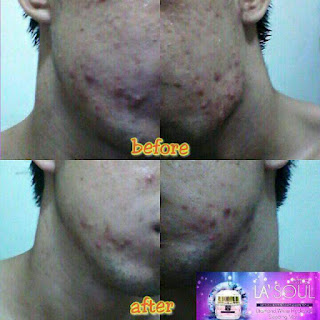 Testimoni La’Soul Diamond Hydration Sleeping Mask, la'soul sleeping mask testimoni, la'soul sleeping mask review, testimoni lasoul sleeping mask, testimoni la soul sleeping mask,testimoni la soul diamond, diamond white hydration sleeping mask