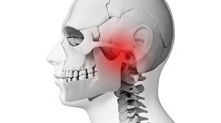Cefaleia e a Disfunção Temporo Mandibular