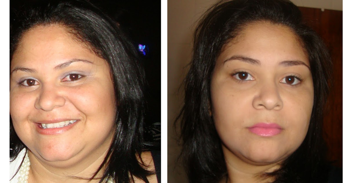 Fazendo as pazes com a balança SLEEVE GÁSTRICO Meu primeiro