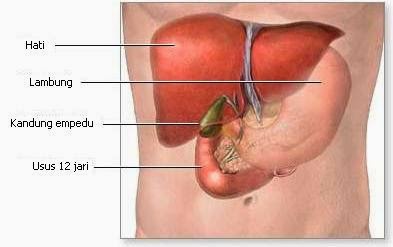 Cara Menghilangkan Batu Empedu Secara Alami