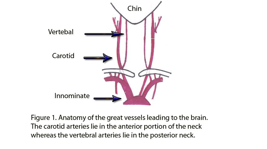 HEALTH FROM TRUSTED SOURCES: Carotid artery disease