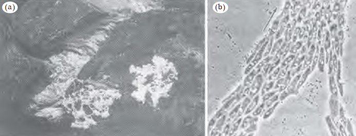 Jamur Lendir Ciri Ciri Contoh Jamur Lendir Myxomycota Dan Acrasiomycota