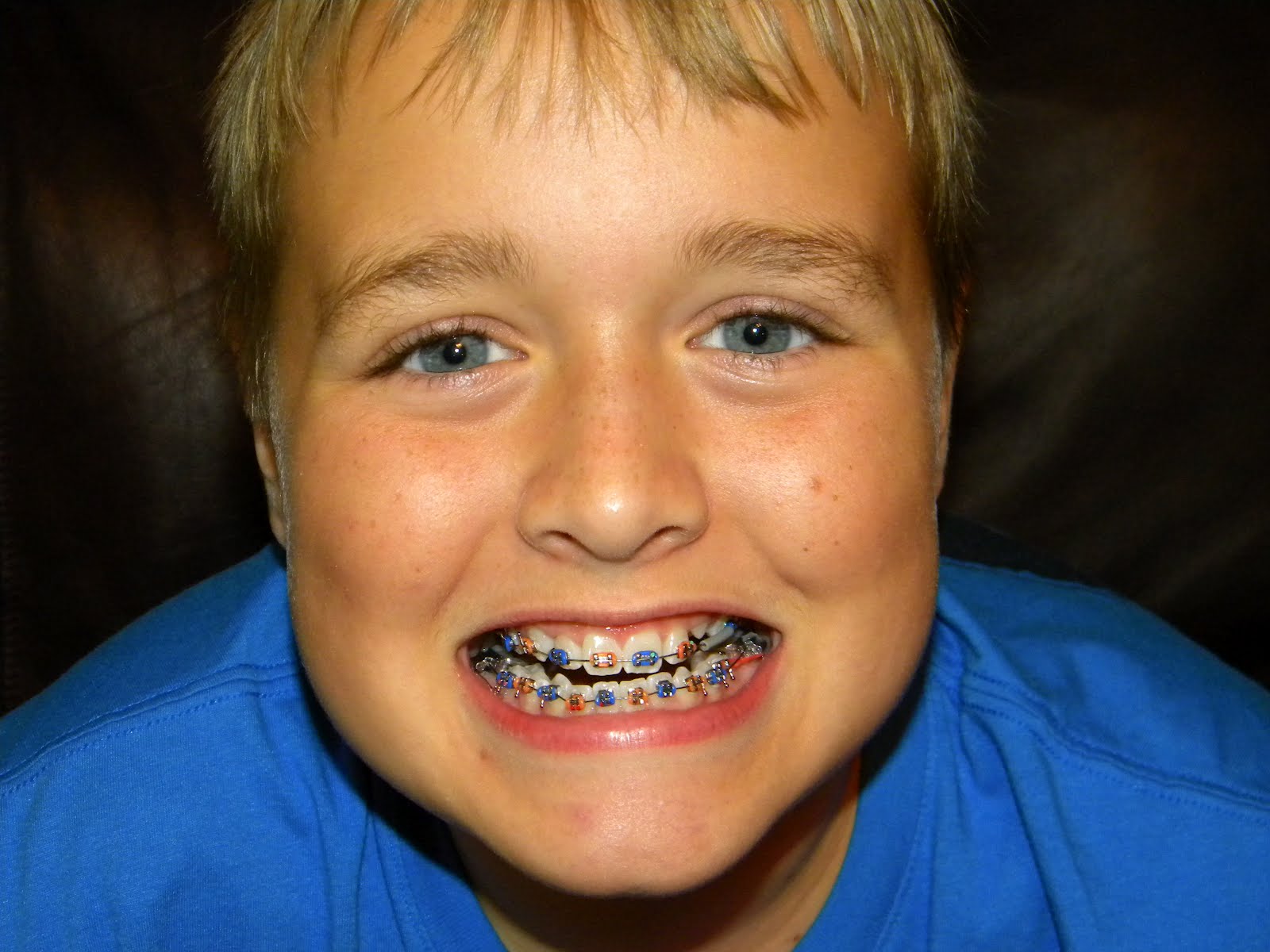 my blue eyed boys School & Braces